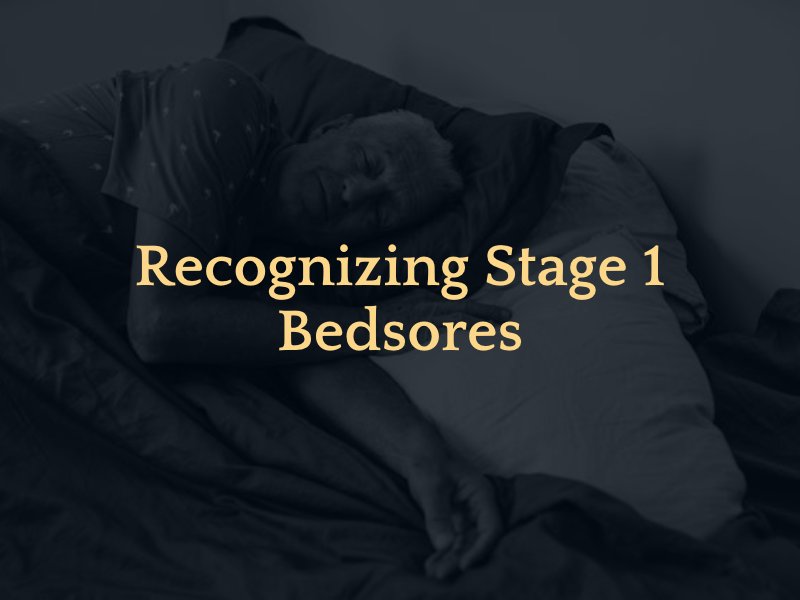 Recognizing Stage 1 Bedsores